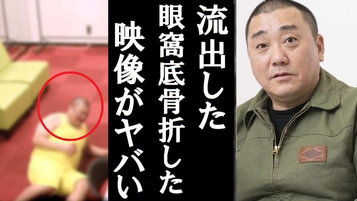 【衝撃】山本圭壱が収録中に眼窩底骨折してしまった映像がガチでヤバすぎる 「極楽とんぼのタイムリミット」の収録中に起こったハプニングに一同騒然 Xoxo Japan 